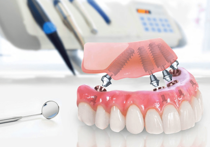 The Best Dental Clinic in Maroubra and What Makes it Different from the Competition