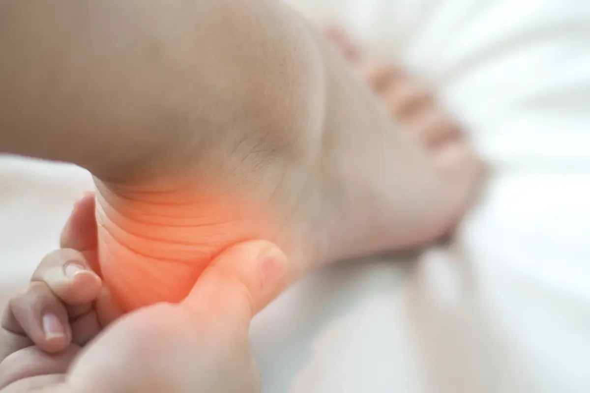 plantar fasciitis in heel treatment